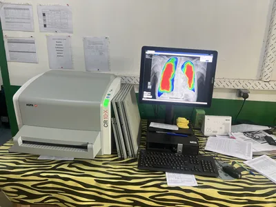 Un poste de radiologie numérique avec un lecteur de plaques AGFA et un ordinateur affichant une radiographie thoracique en fausses couleurs, sur