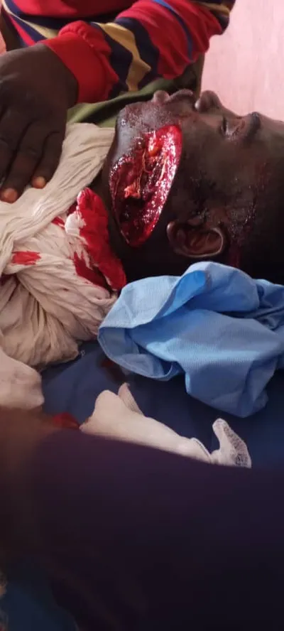 Victime d’un soldat au village 5 Kilos